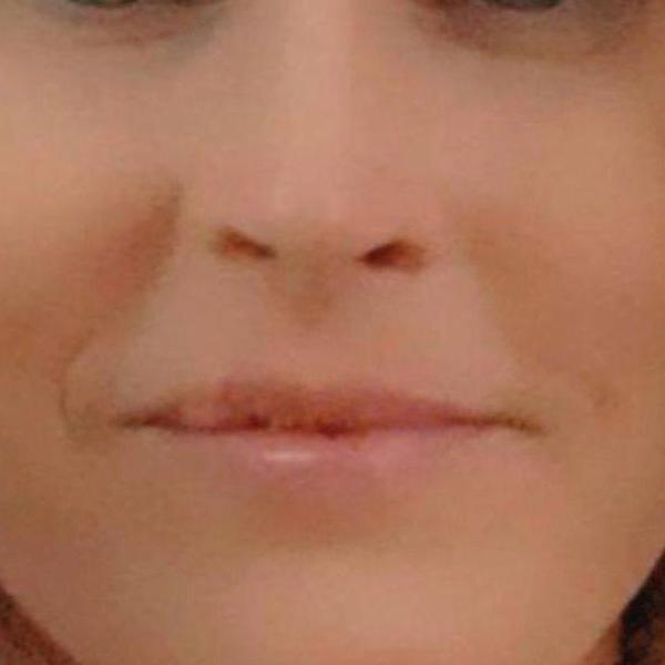 DANA